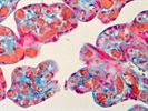HRP Substrates