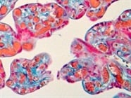 HRP Substrates