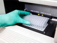 reverse transcriptase pcr