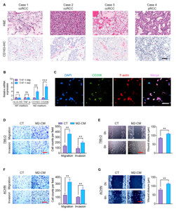 FITC anti-human CD206 (MMR) 321104 from BioLegend
