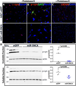 Anti-Alpha-synuclein aggregate antibody [MJFR-14-6-4-2