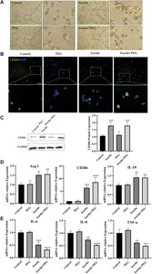 FITC anti-human CD206 (MMR) 321104 from BioLegend