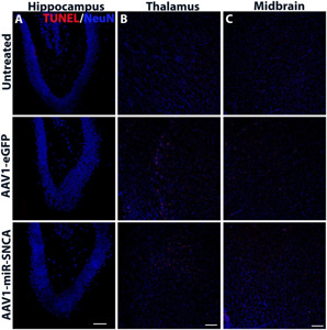 アブ1700 Anti-alpha-synuclein aggregate antibody [MJFR-14-6-4-2