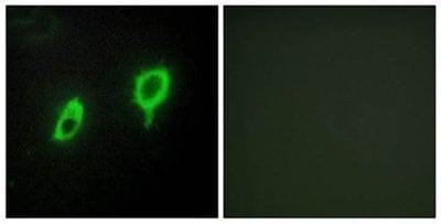 14-3-3  Antibody from Biorbyt
