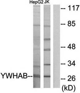 14-3-3  Antibody from Biorbyt