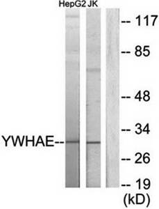 14-3-3  Antibody from Biorbyt