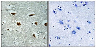 4E-BP1 (Ab-69) Antibody from Biorbyt