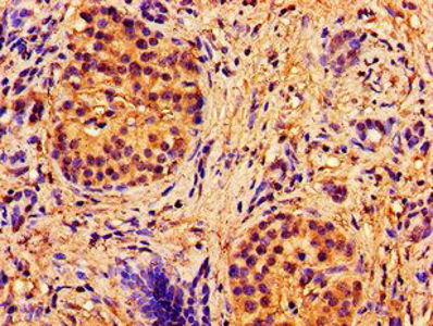 ABCB7 antibody