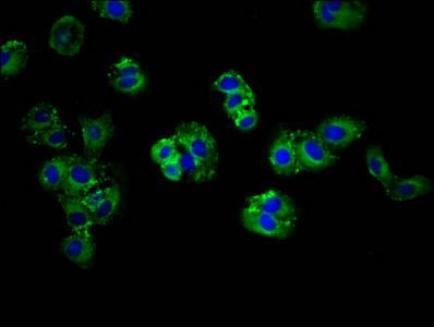 ABCG5 antibody from Biorbyt