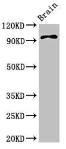 ABR antibody