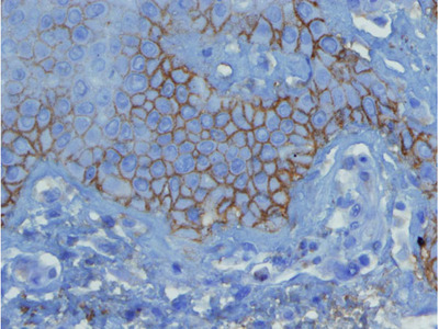 Anti - C3d complement