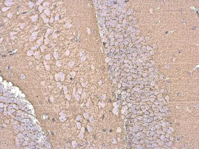 彩片 EAAT2 Antibody (E-1) | SCBT - Santa Cruz Biotechnology