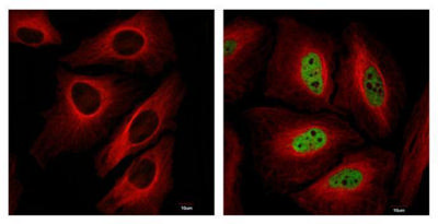 ハラチュウページ HIF1 alpha antibody | GTX127309