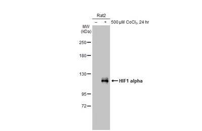 その他 pap 抗HIF1 alpha抗体 | Anti-HIF1 alpha antibody | フナコシ