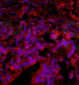minxfoams様 Anti-PACAP antibody GTX37576 from GeneTex | Biocompare.com