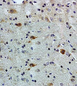 minxfoams様 Anti-PACAP antibody GTX37576 from GeneTex | Biocompare.com