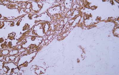 Galectin 3 (ABT-GAL3) Antibody