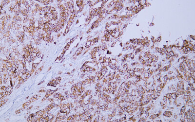 Her-2 (ABT338) Antibody
