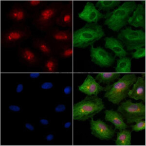 Phospho-Rab8 (Thr72) Antibody