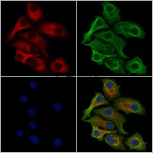 Phospho-EPRS (Ser886) Antibody