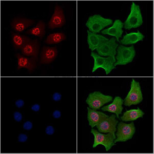 Phospho-RPA32/RPA2 (Ser4/Ser8) Antibody