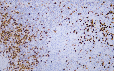 IRF-4/MUM1 (ABT080) Antibody