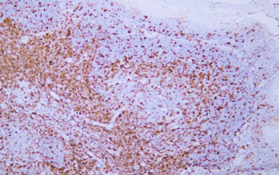 CD5 (ABT-CD5) Antibody