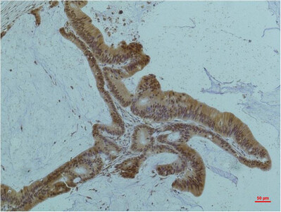 Smad3 Monoclonal Antibody (6F7)
