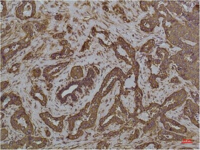 GRP78/Bip Monoclonal Antibody (8G3)