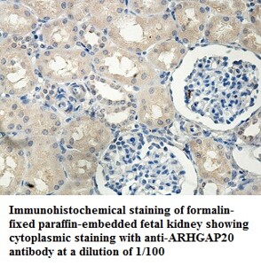 ARHGAP20 Antibody