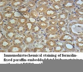 ABHD8 Antibody