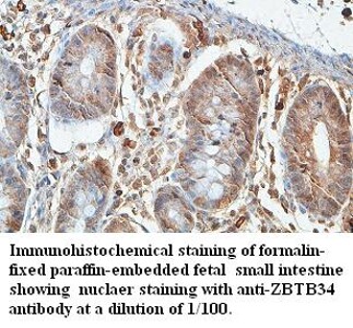 ZBTB34 Antibody