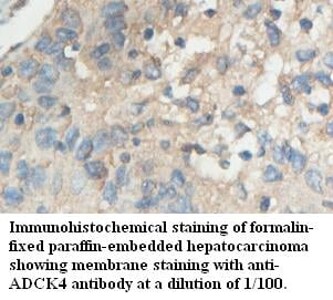 ADCK4 Antibody