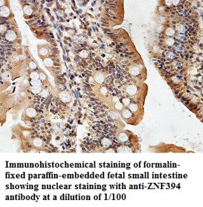 ZNF394 Antibody