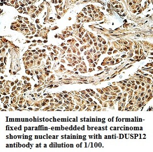 DUSP12 Antibody