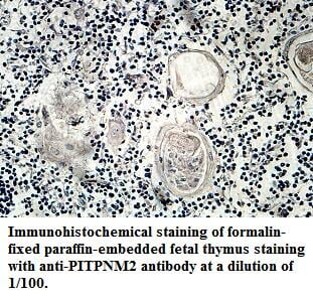 PITPNM2 Antibody