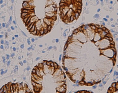 CK18 Antibody