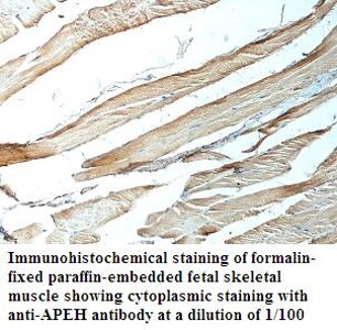 APEH Antibody