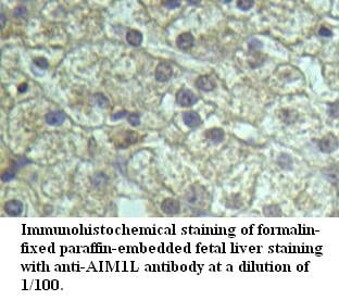 AIM1L Antibody