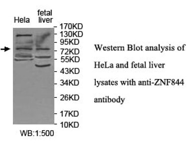 ZNF844 Antibody