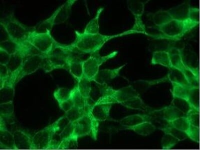 Mouse anti PSMA Antibody