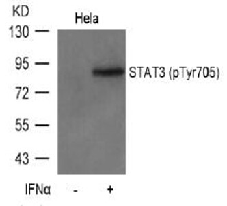 STAT3 (phospho-Tyr705) Antibody