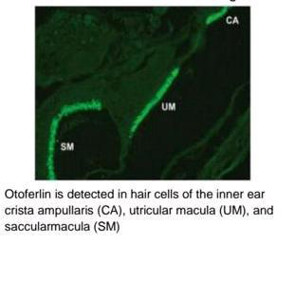 Otoferlin Monoclonal Antibody