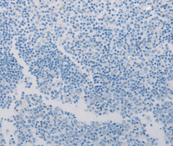 ADCYAP1R1 Antibody
