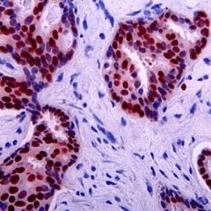MOUSE ANTI p53 (aa20-25) Antibody