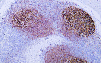 CD35 (ABT-CD35) Antibody