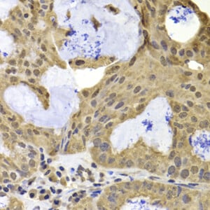TERF2IP Polyclonal Antibody