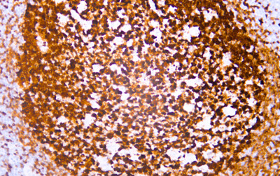 BOB.1 (ABT-BOB1) Antibody