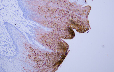 Cytokeratin 4 (ABT061) Antibody