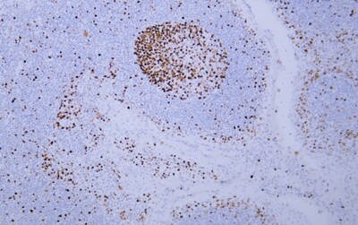 MCM2 (ABT-MCM2) Antibody